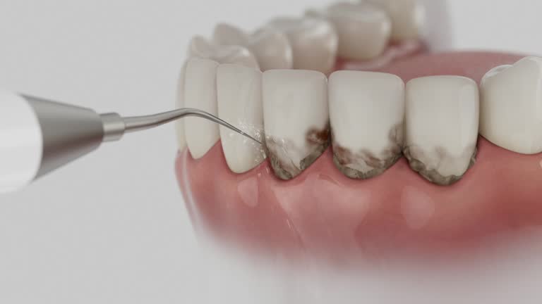 Reliable Dental Implants contractor in St. Joseph, IL by Smile Center Dentistry